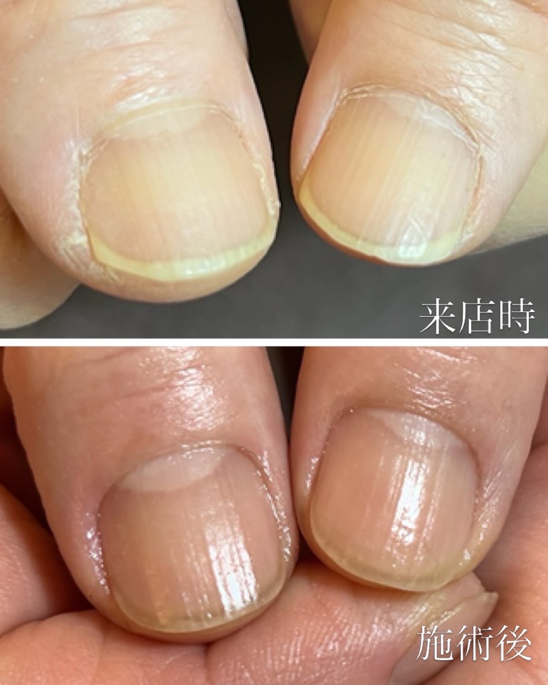爪を育てるネイルサロン ネイル アイリー