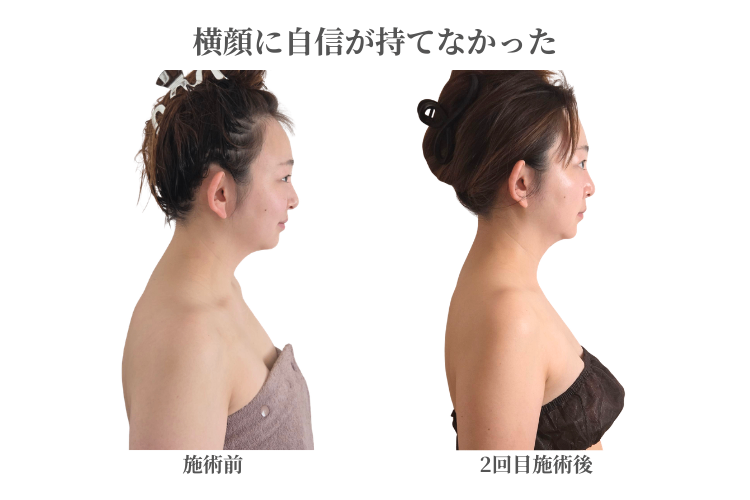 骨から変える老け見え改善サロンOla水戸