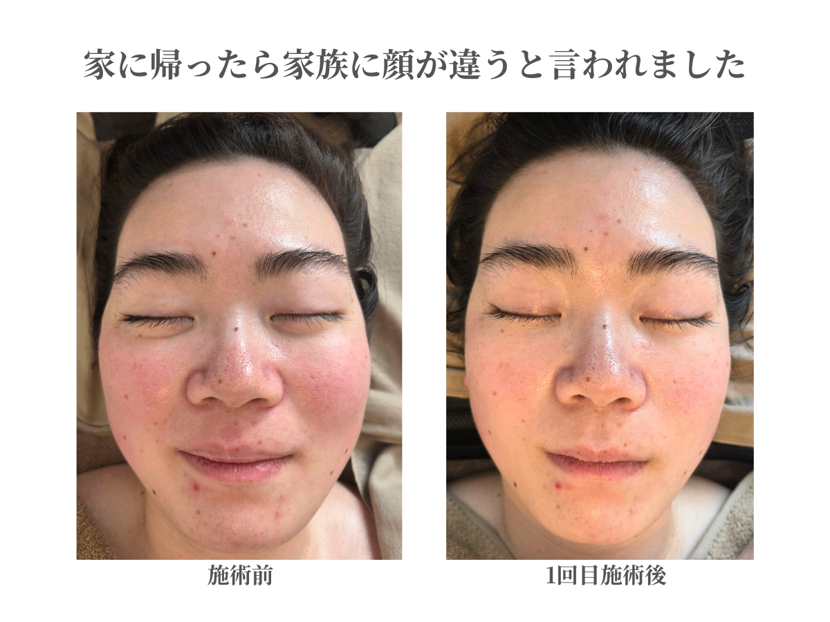 骨から変える老け見え改善サロンOla水戸