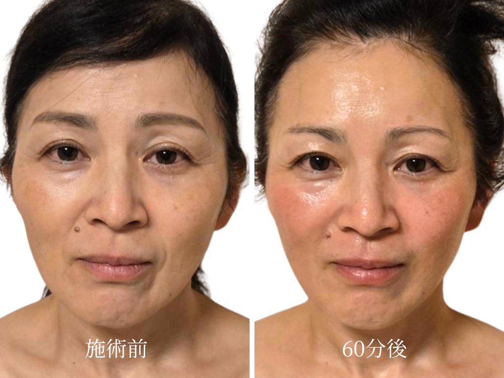 骨から変える老け見え改善サロンOla水戸