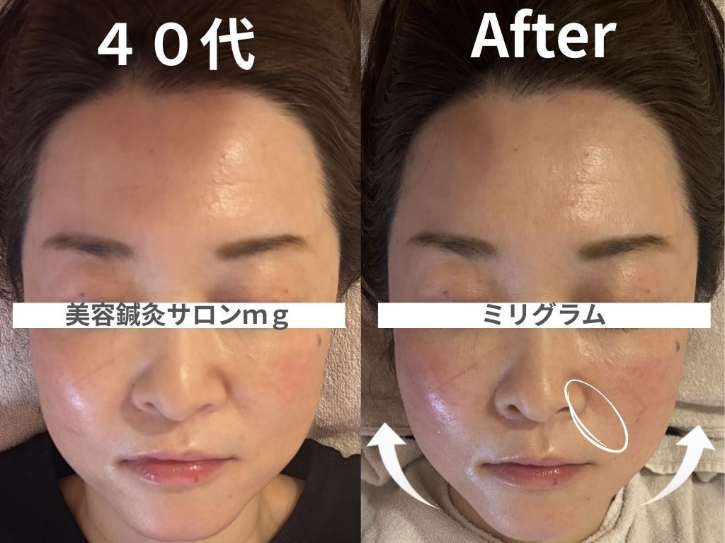 美容鍼灸サロンmg｜名古屋市千種区・愛知