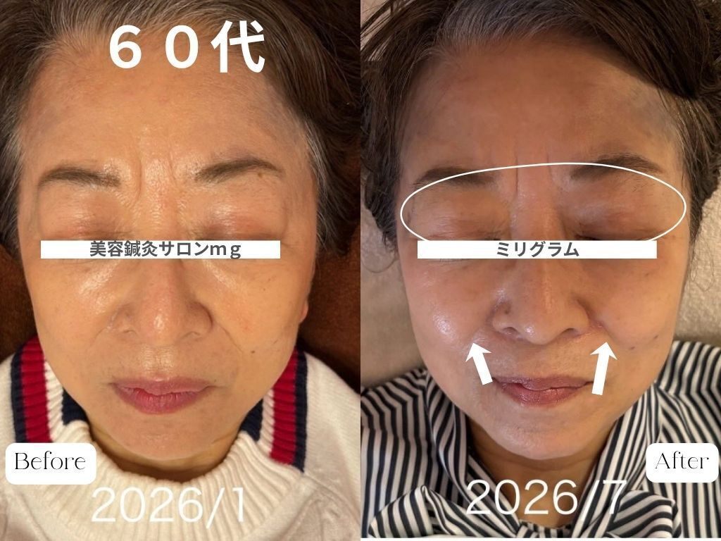 美容鍼灸サロンmg｜名古屋市千種区・愛知