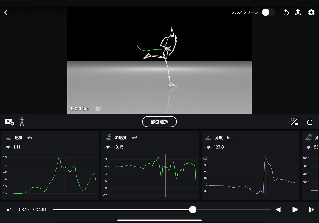 埼玉整形外科スポーツクリニック