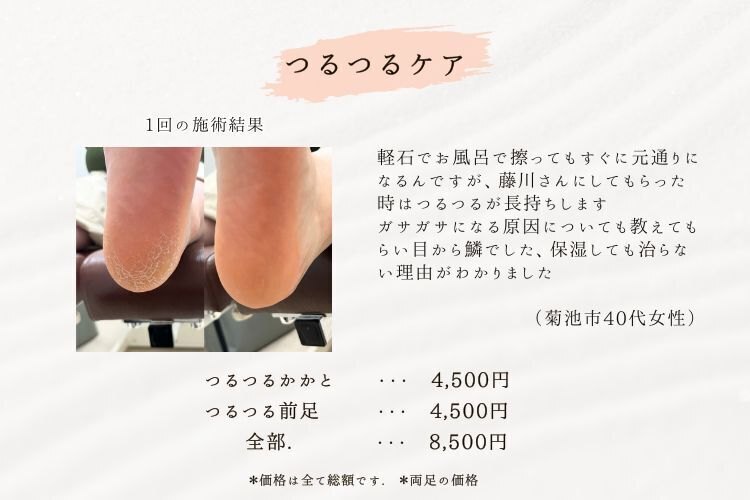 ダ・ヴィンチのあし健軍店|うおのめ・たこ