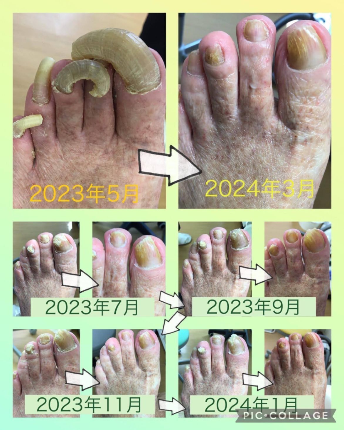 フットケアスクール天使のつめきり大宮