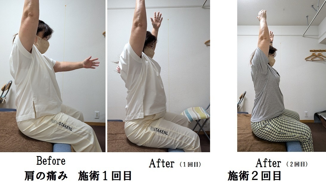 整体（姿勢・痛み・聴覚と視覚の情報処理）