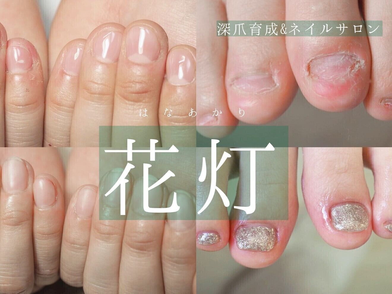 深爪育成特化ネイルサロン花灯