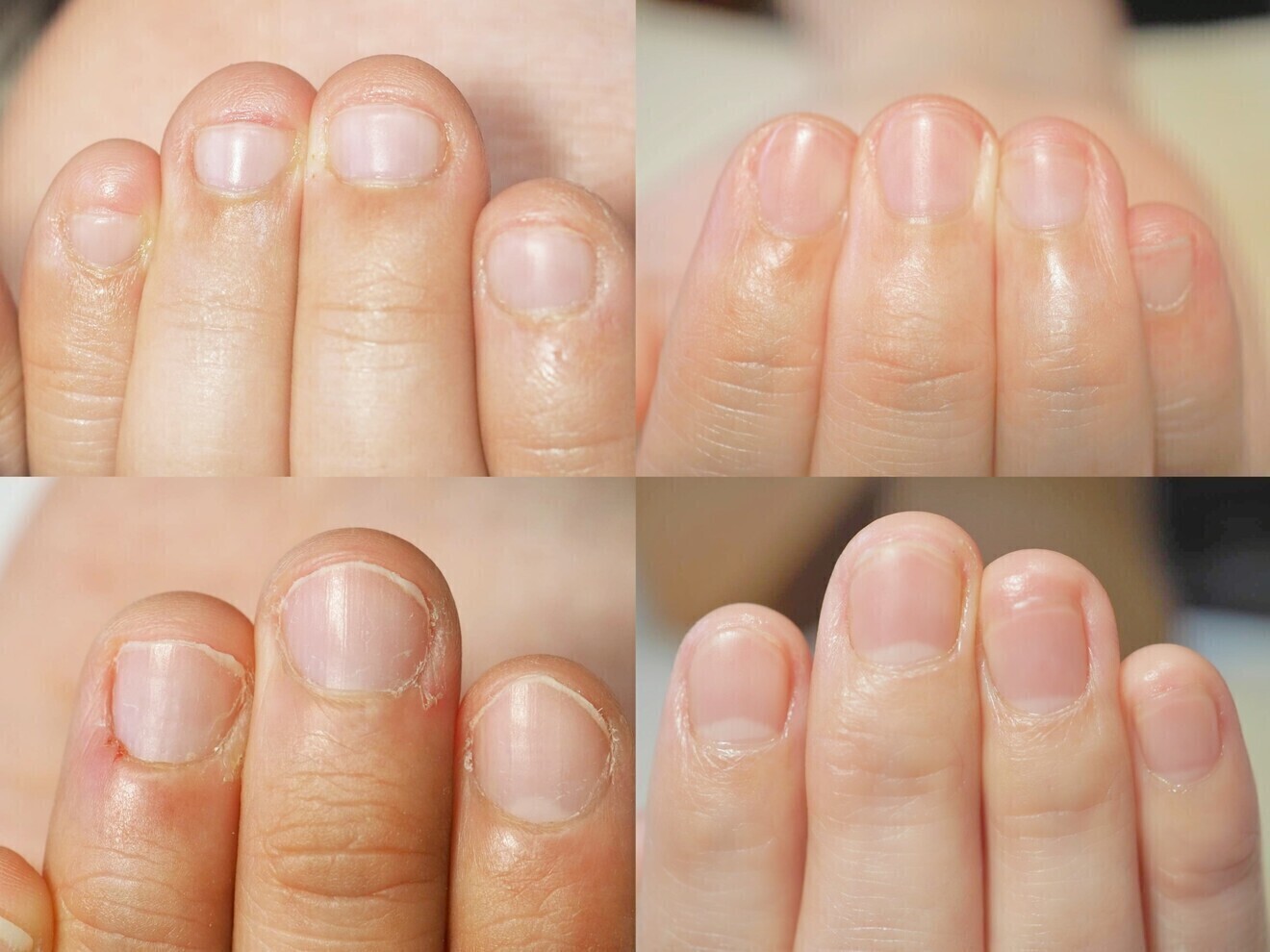 深爪育成特化ネイルサロン花灯