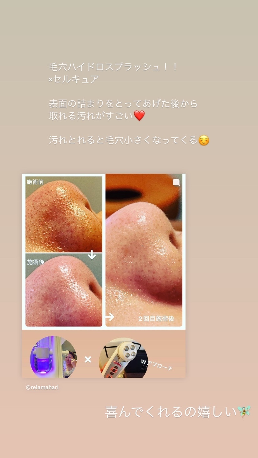 Relama美容鍼×マッサージ