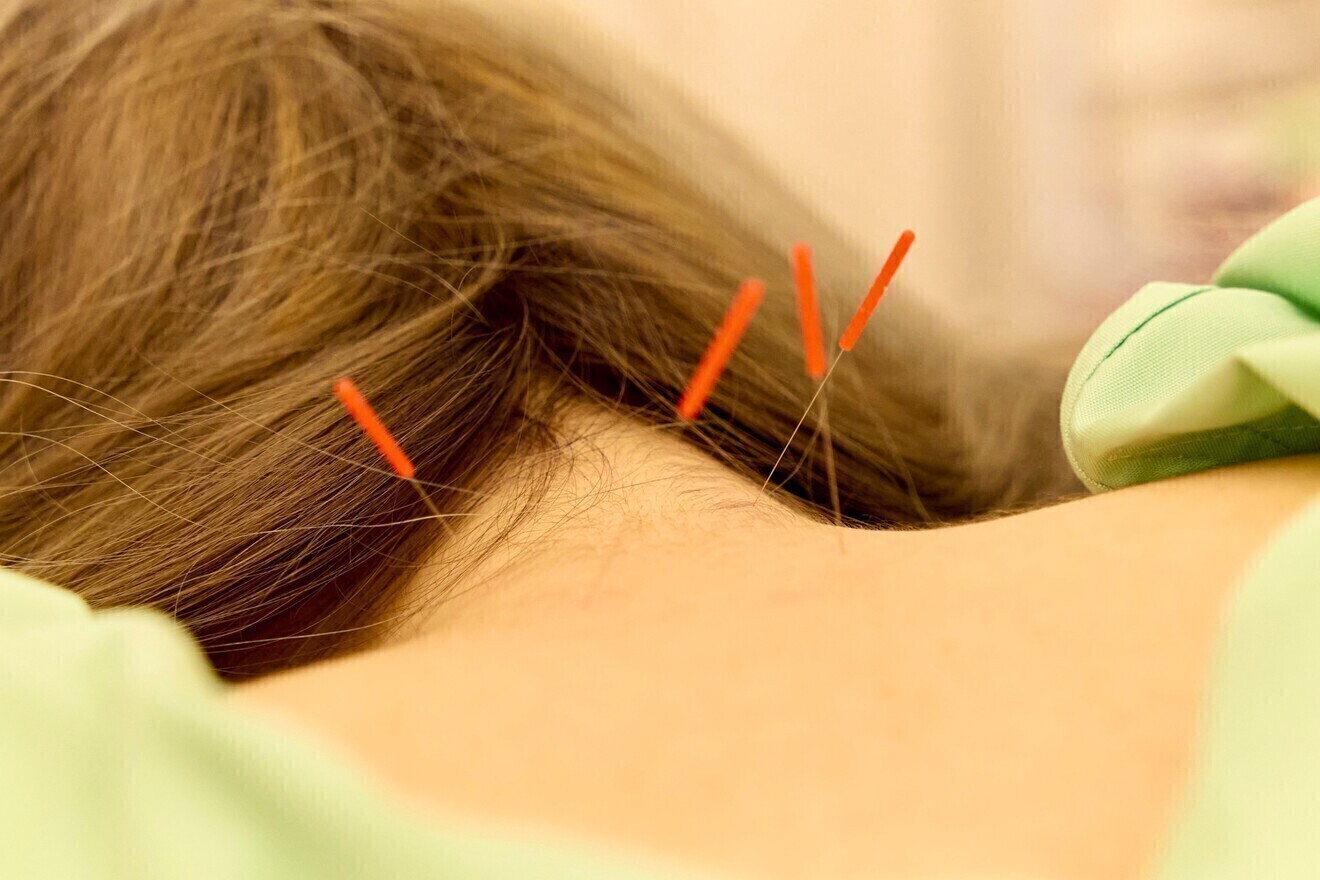 鍼灸整体ととのう　別府本院