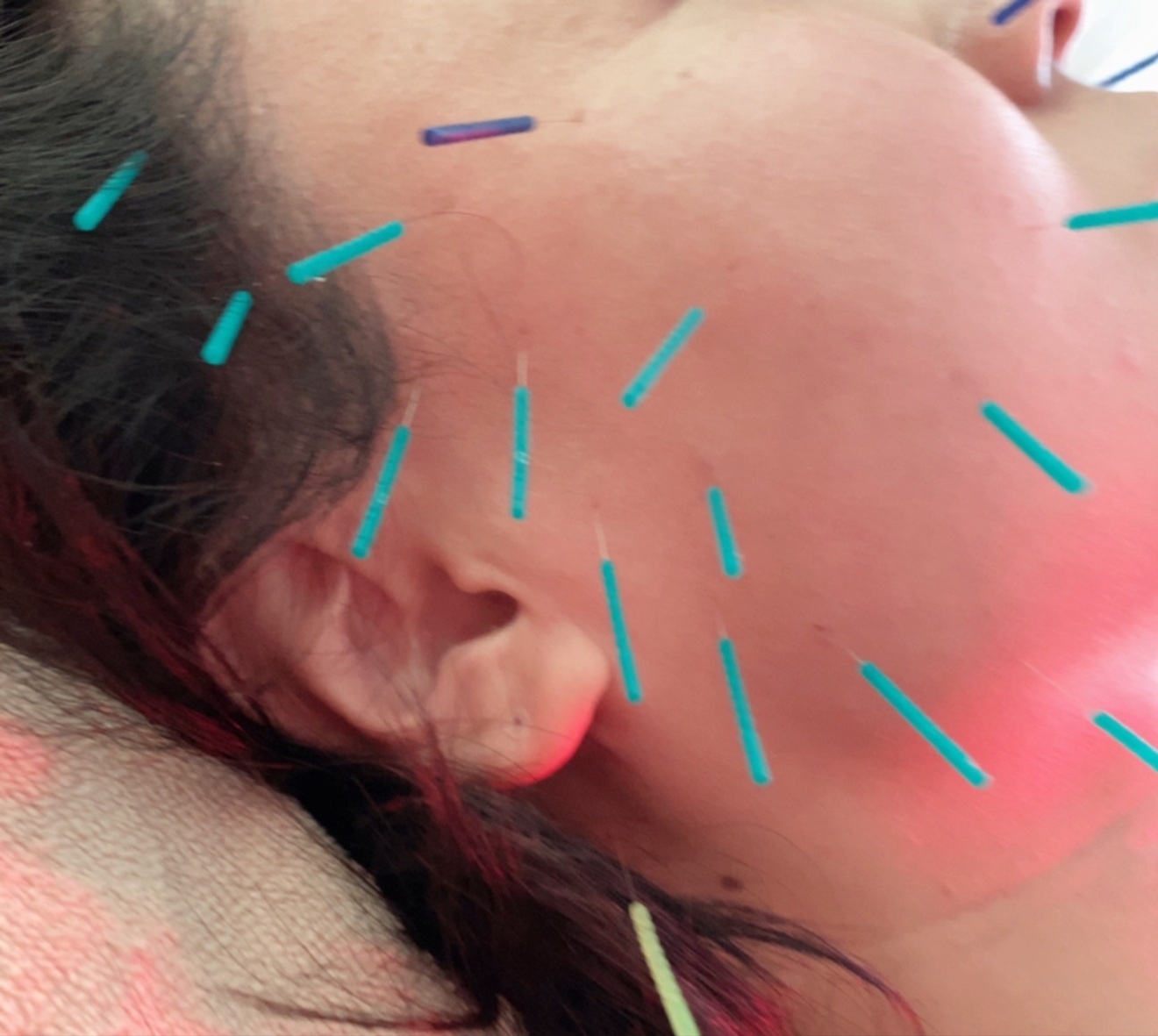 美容鍼灸&リラク　プライベートサロン晴