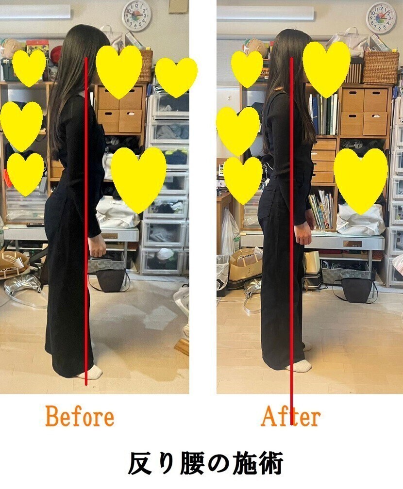 整体（姿勢・痛み・聴覚と視覚の情報処理）