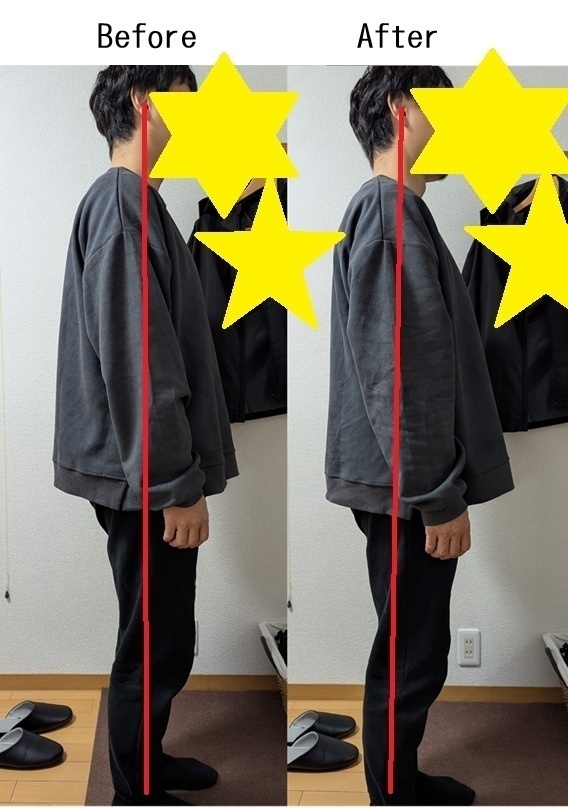 整体（姿勢・痛み・聴覚と視覚の情報処理）