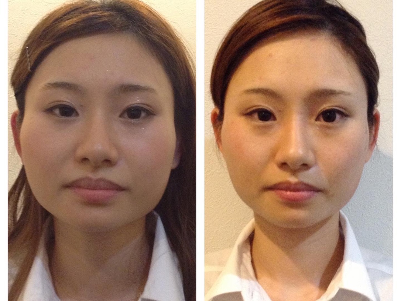 けんぴの美容整体＆小顔矯正【富士市】