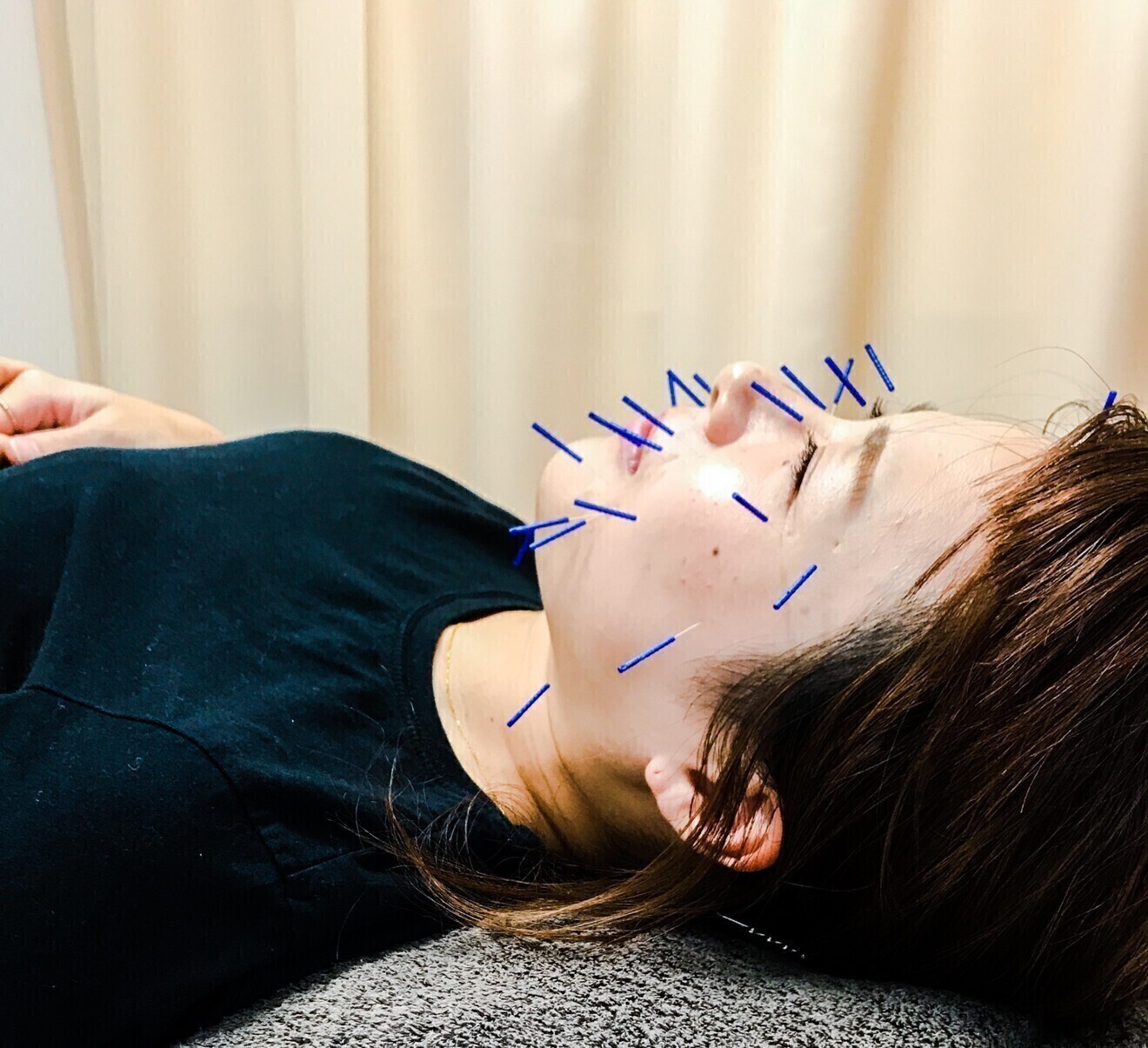 CoreCare治療院（コアケア）札幌市