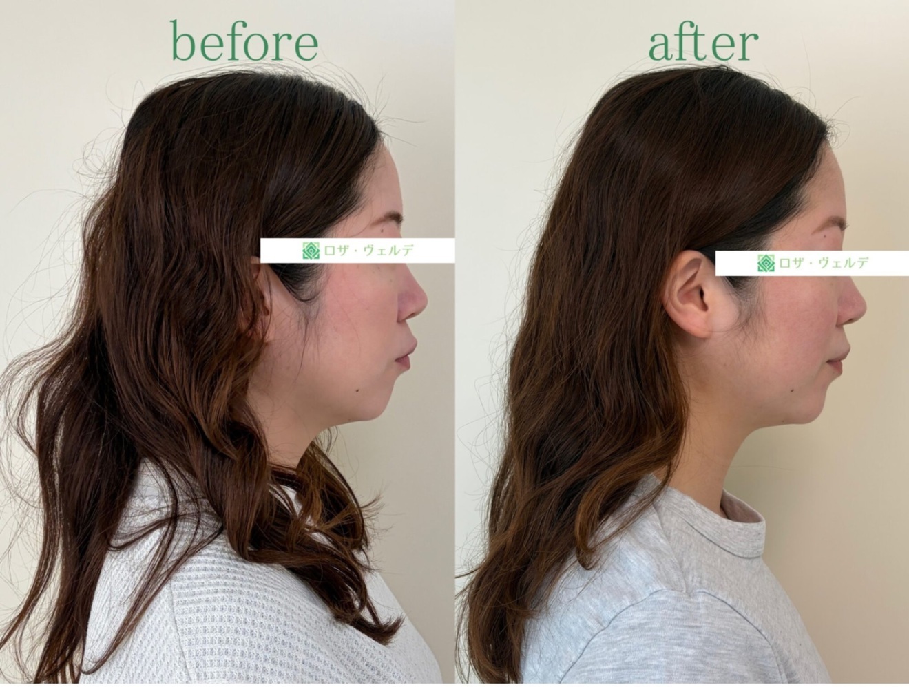 ロザ・ヴェルデ