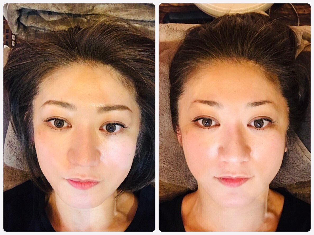 アーキュレイトボディ