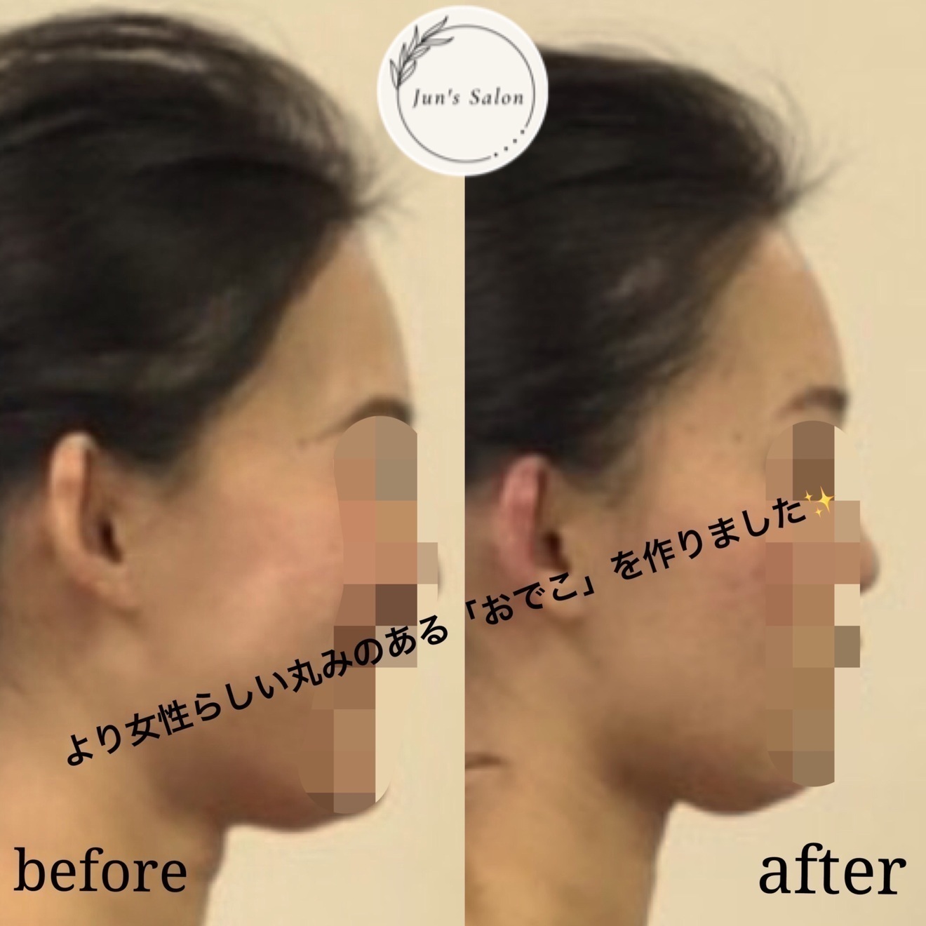 整体・小顔Salon『N』