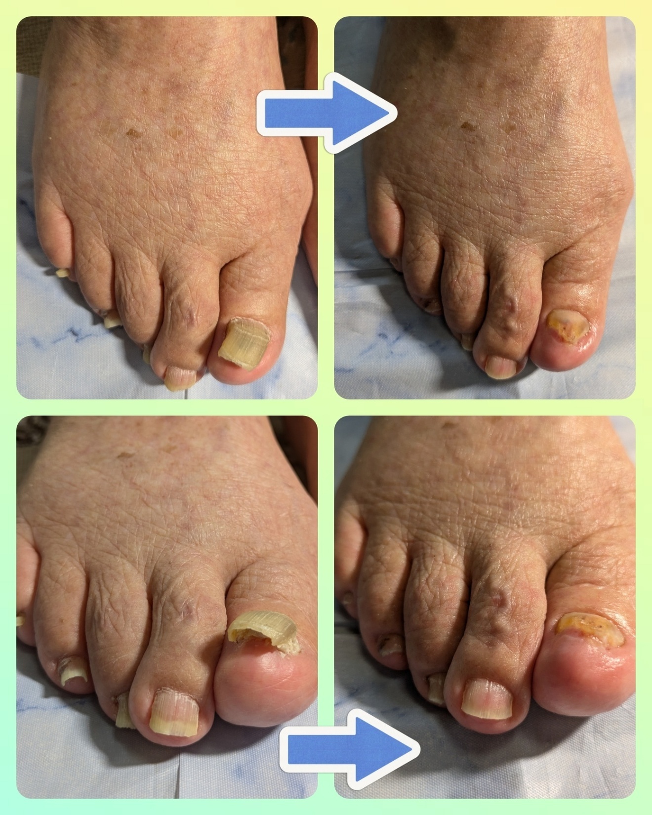 埼玉県　さいたま市　天使のつめきり大宮