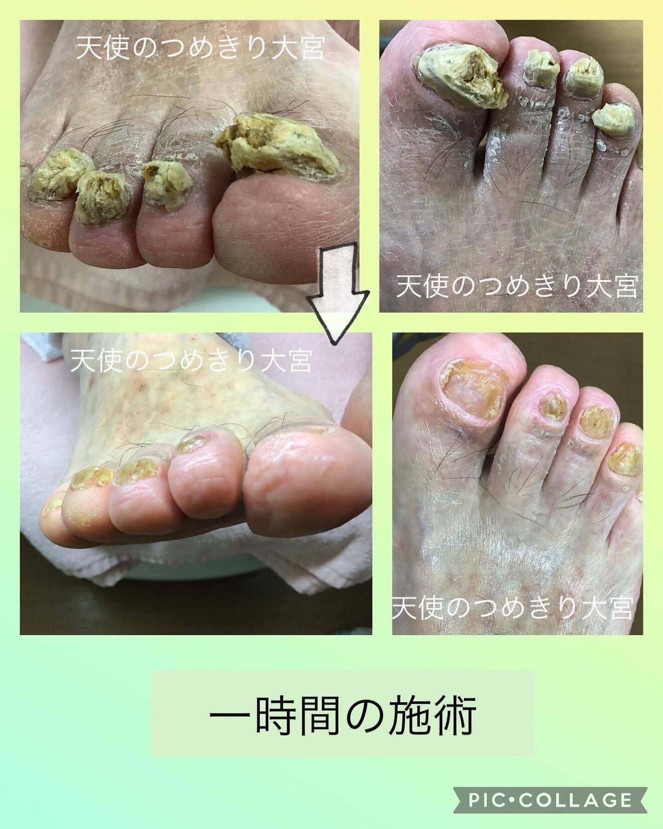 埼玉県　さいたま市　天使のつめきり大宮