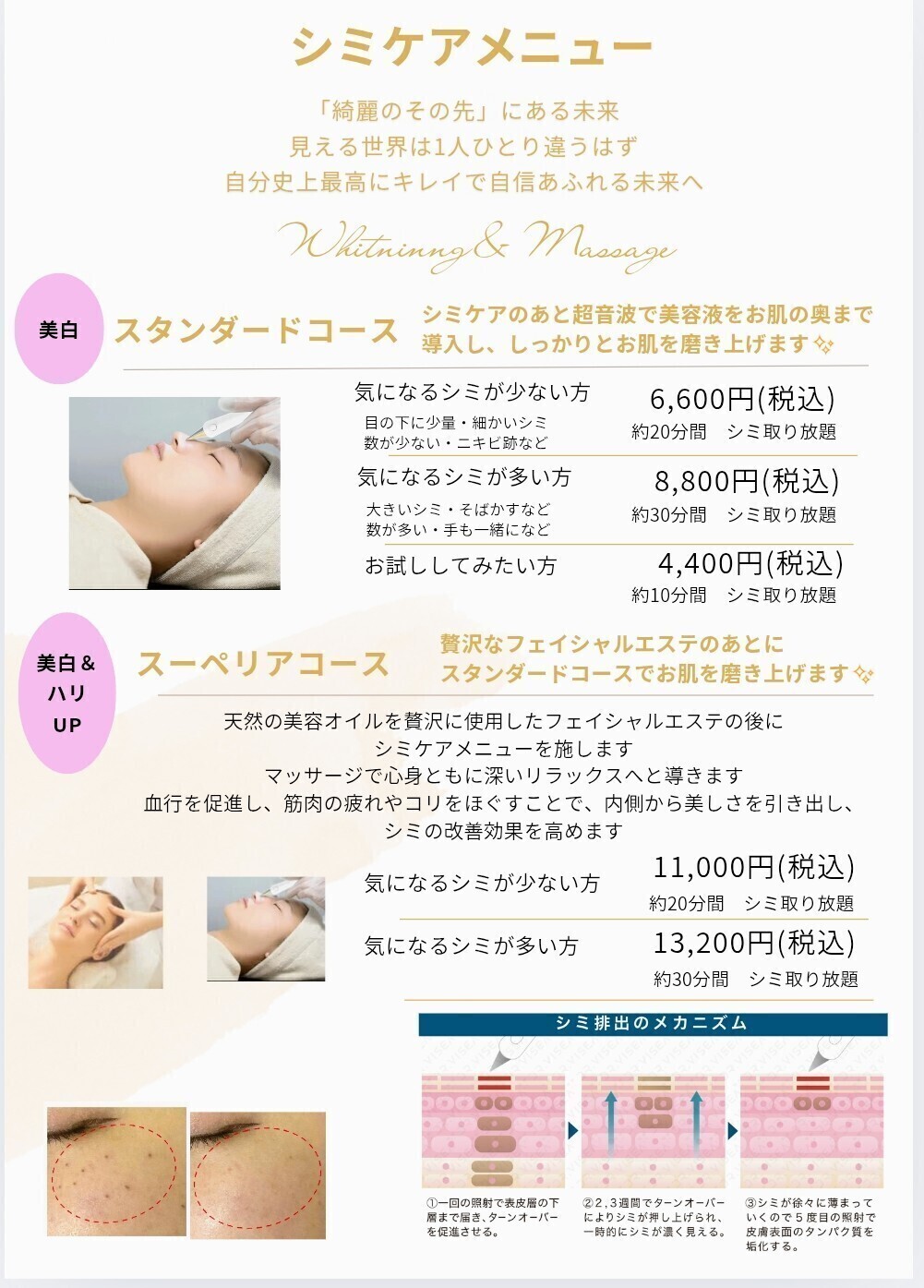 脱毛エステサロン【綺麗のそのさき】盛岡市