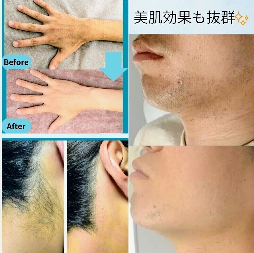 脱毛エステサロン【綺麗のそのさき】盛岡市