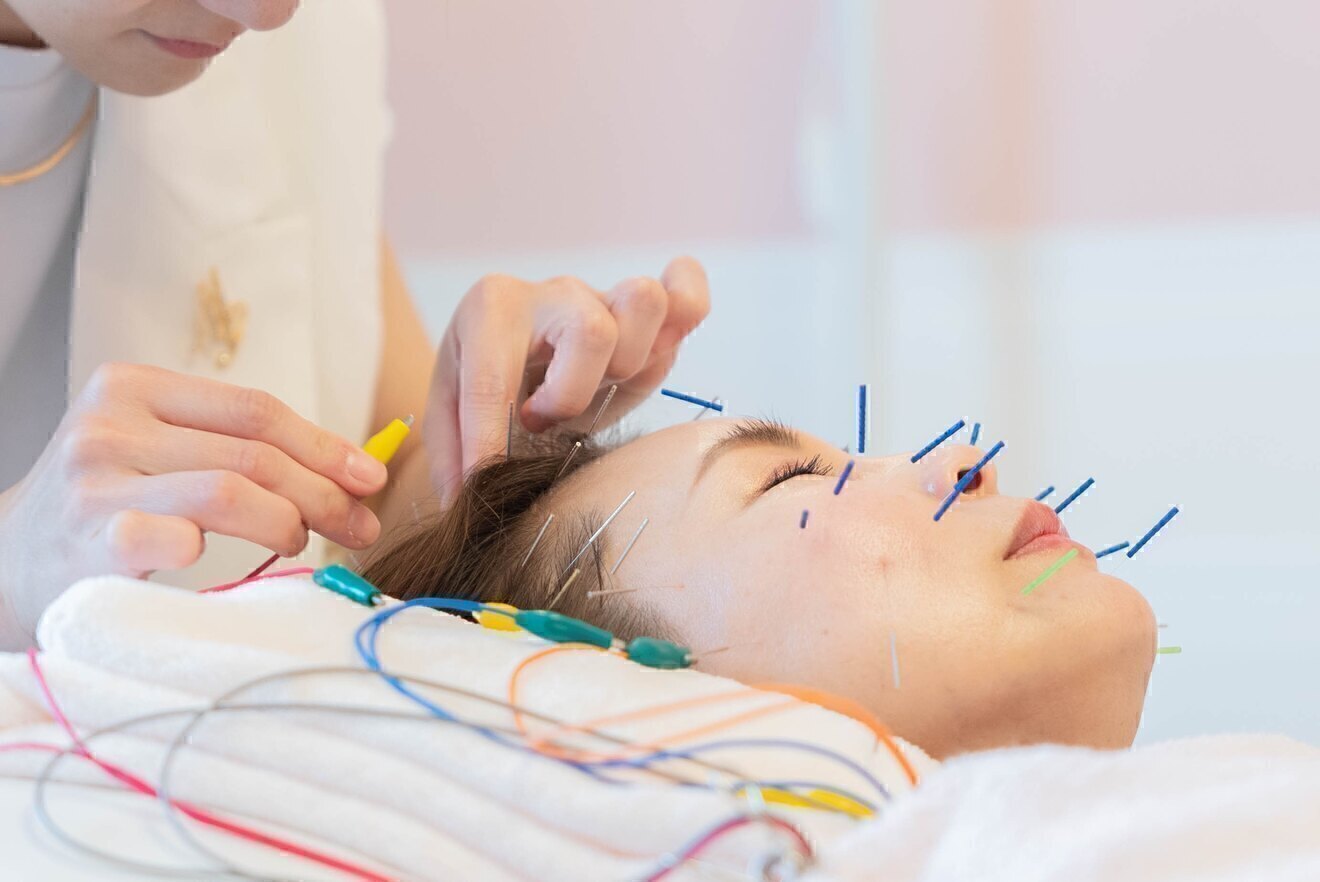 美容鍼灸サロンmg　愛知県名古屋市千種区