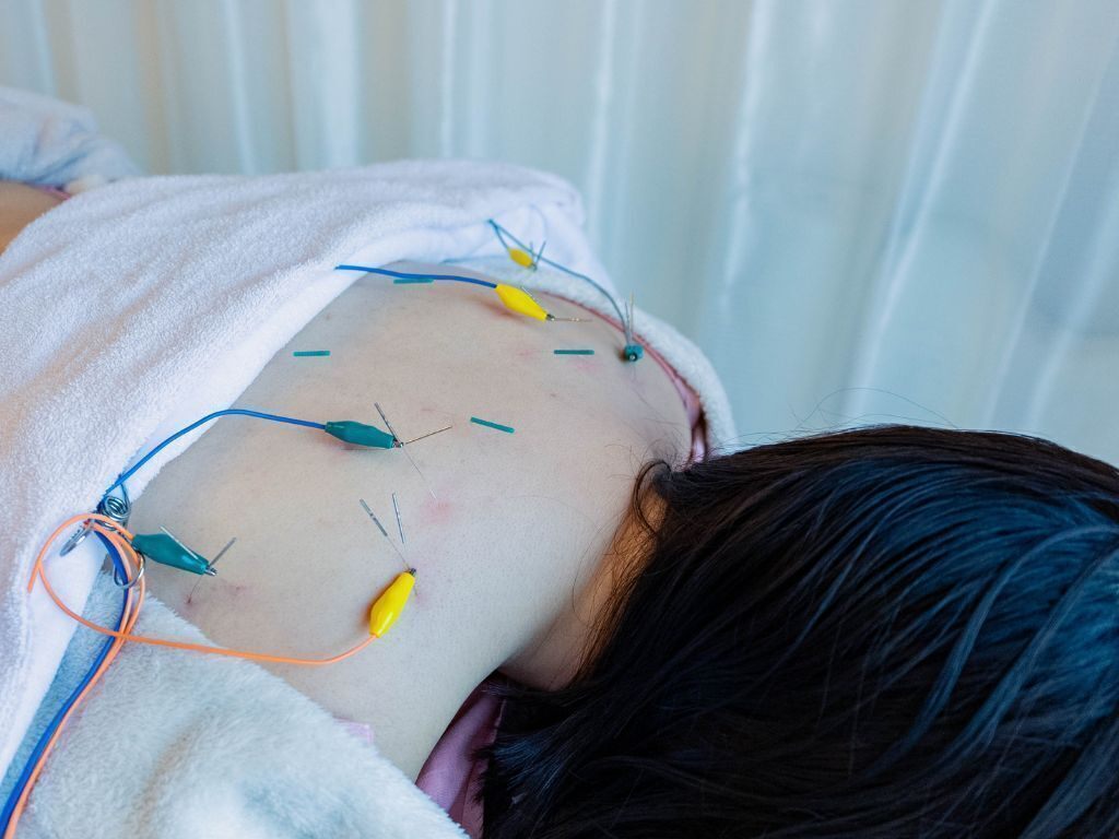 美容鍼灸サロンmg　愛知県名古屋市千種区