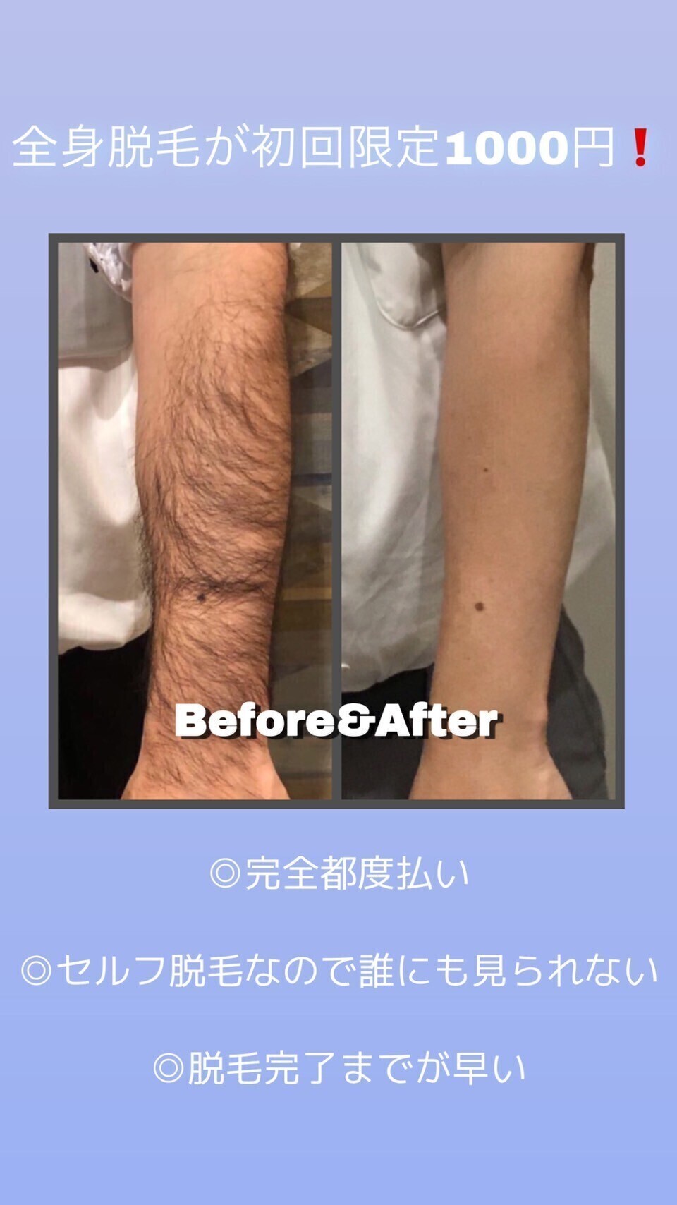 【セルフ脱毛専門店】キングスサロン神戸