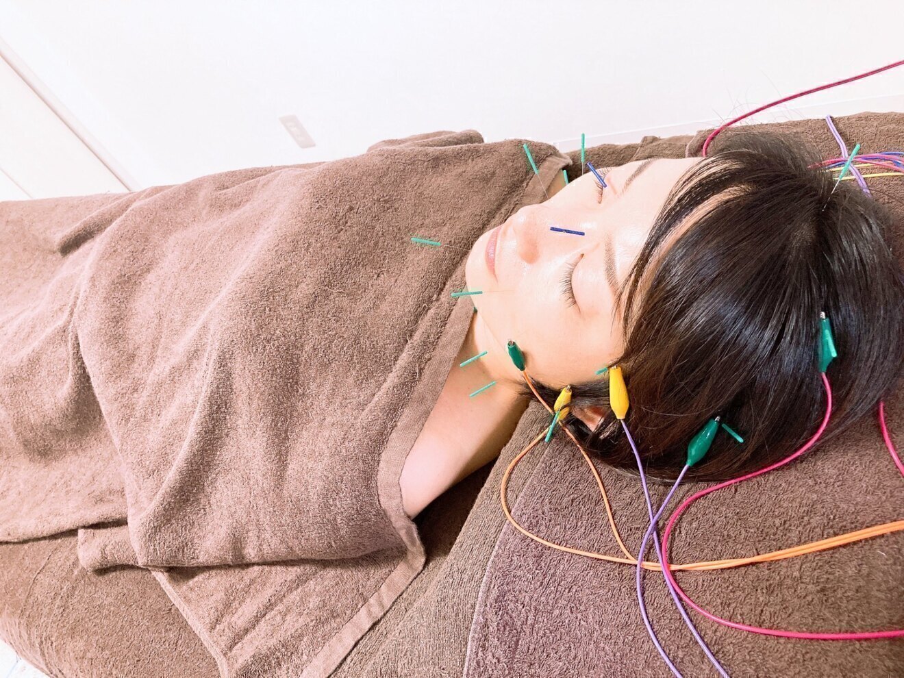 恵比寿鍼灸院ハリステーション/代官山渋谷