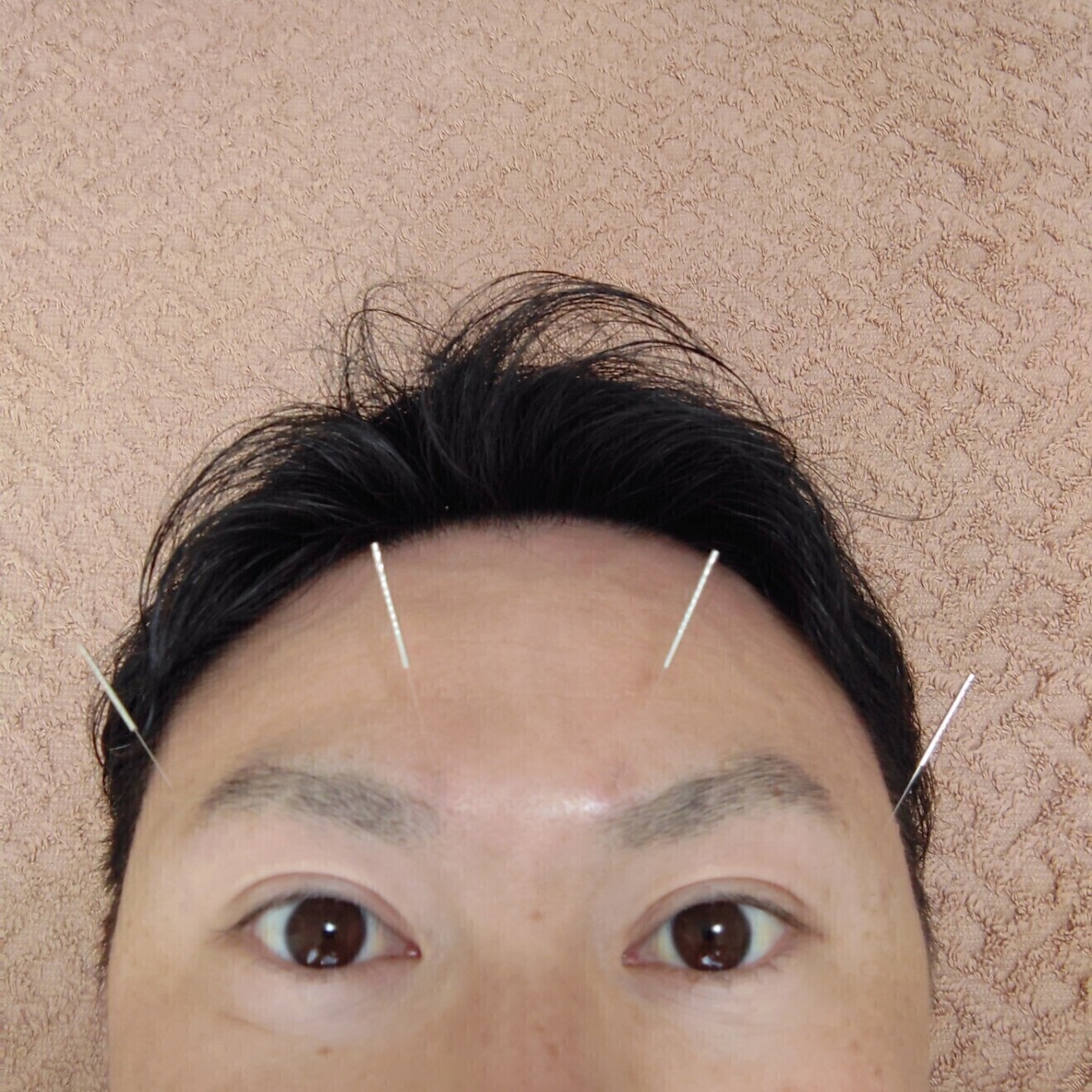 ワッポンの鍼灸整体院