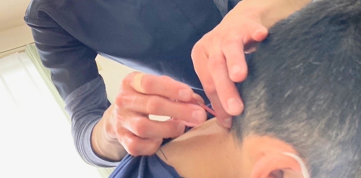 ワッポンの鍼灸整体院