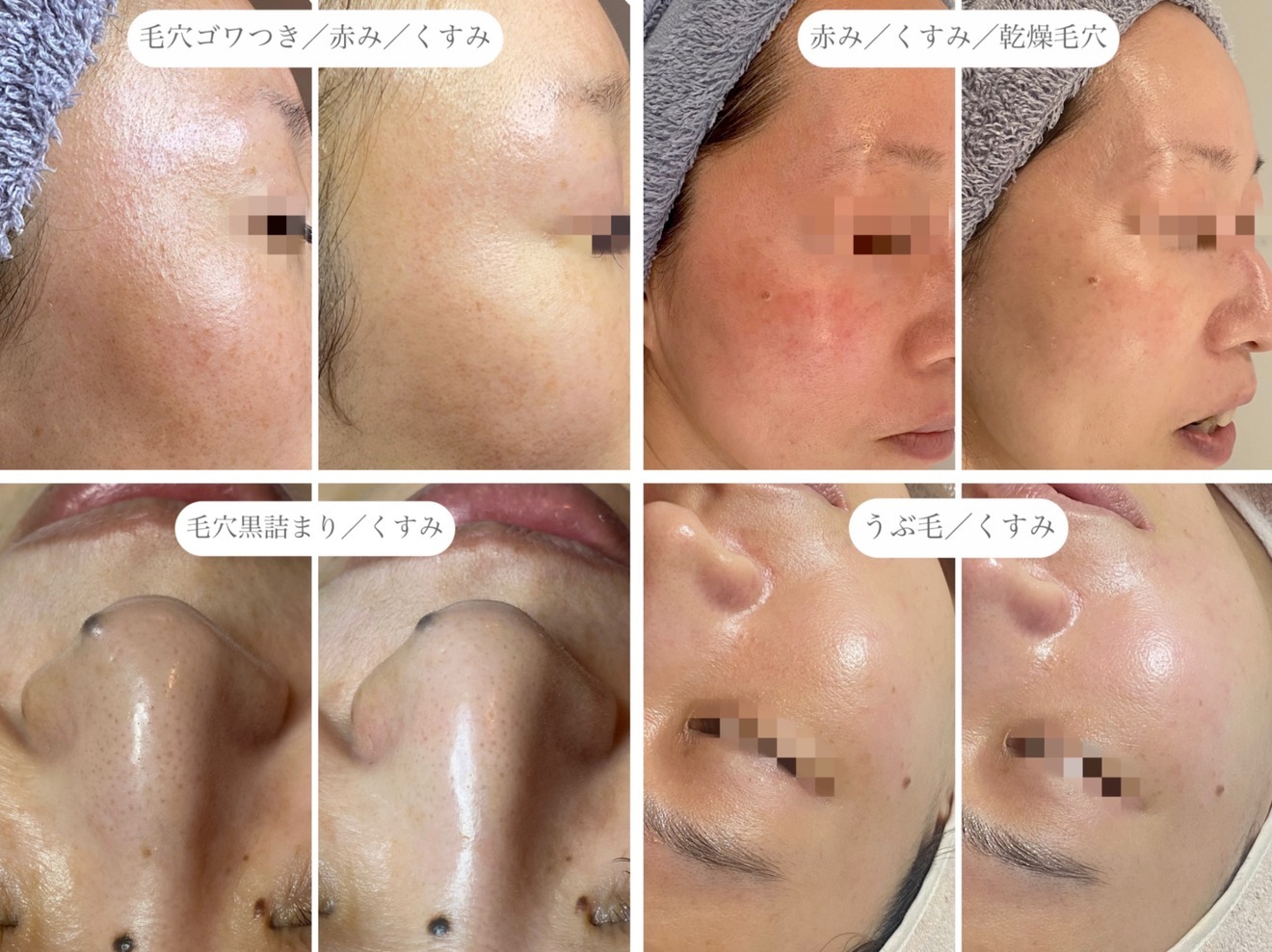 flux(フラックス）