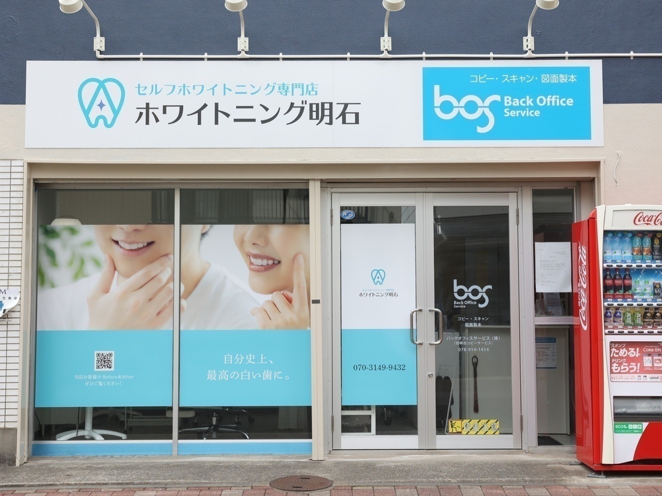 セルフホワイトニング　ホワイトニング明石