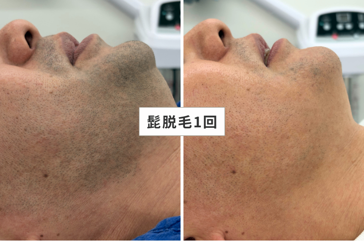 MEN'S GOD┃兵庫・明石の脱毛店