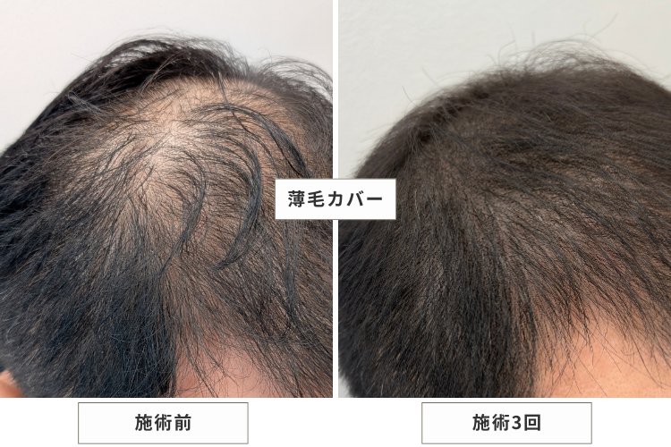 MEN'S GOD┃兵庫・明石の脱毛店