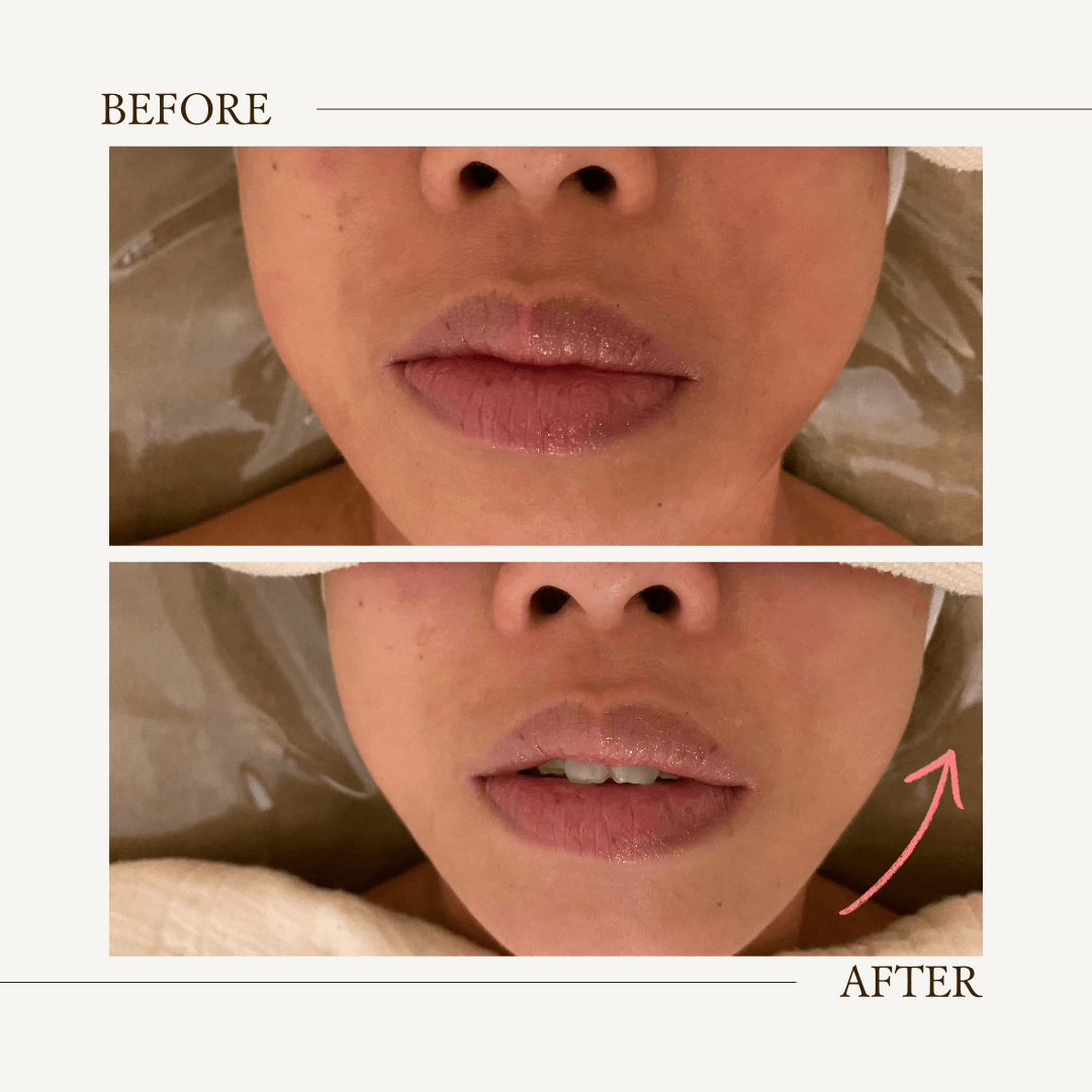 デンタルエステ　cranberry