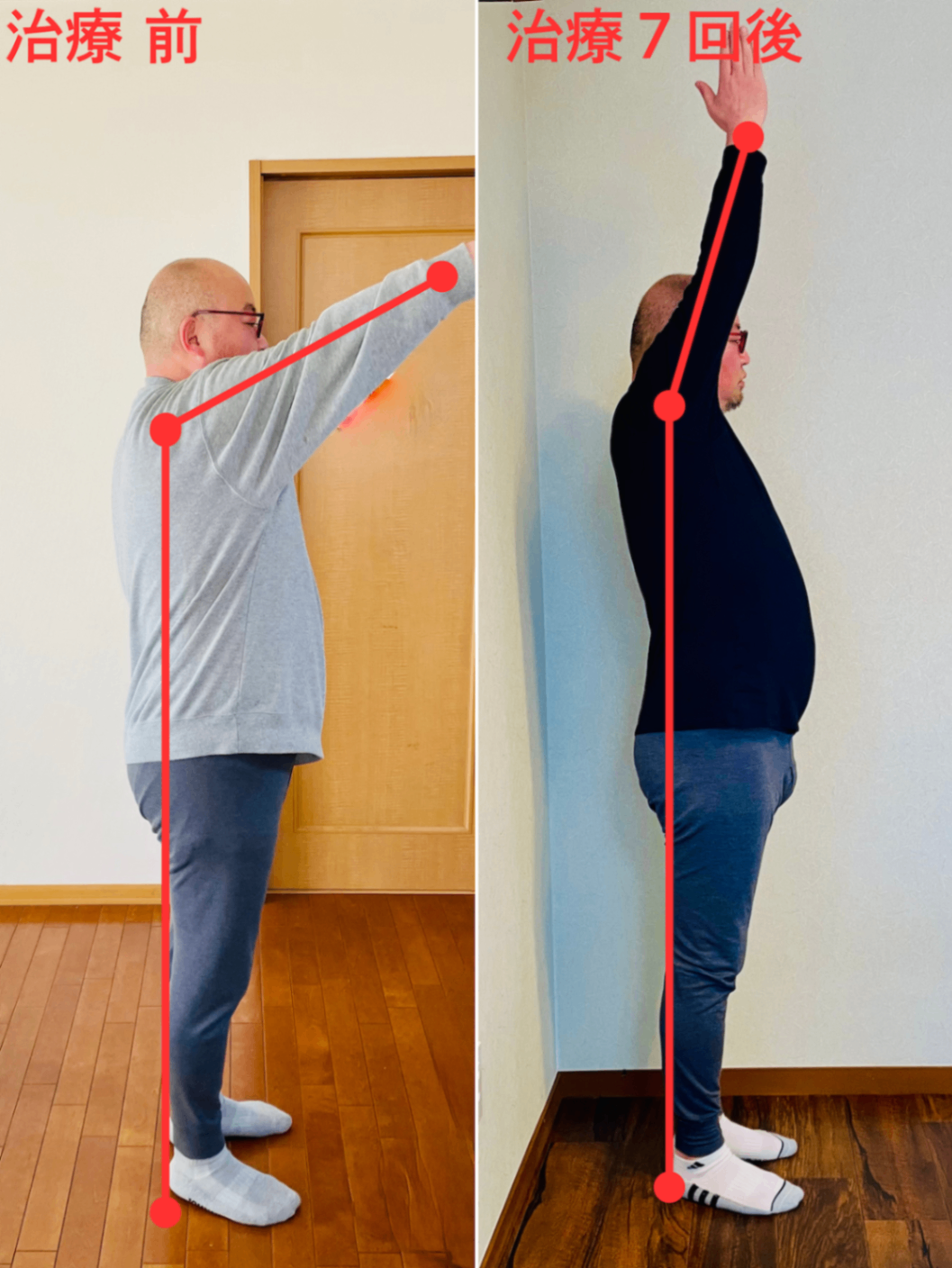 【東京・埼玉】腰痛・肩痛を姿勢から改善