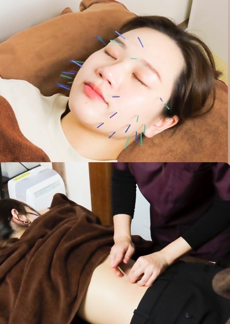 〜ARiSH〜骨盤調整＆はり灸