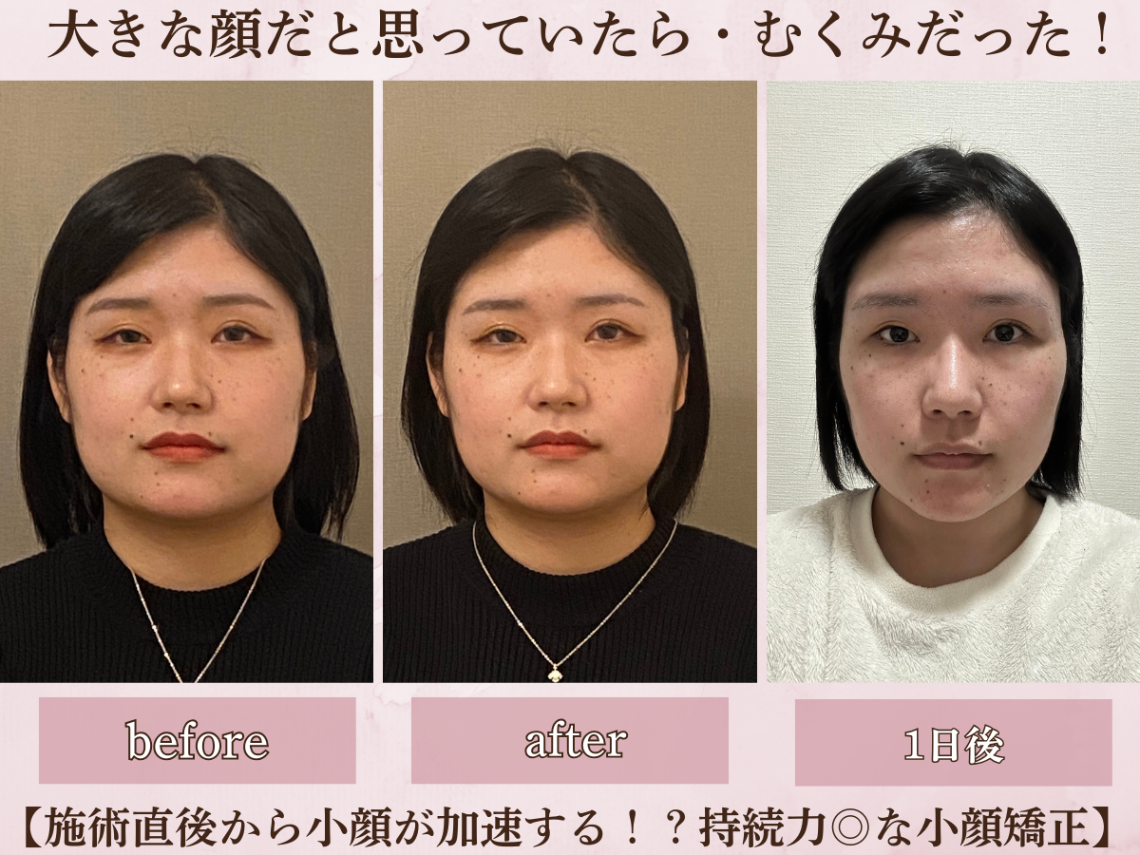 立体小顔矯正専門サロン　フラン