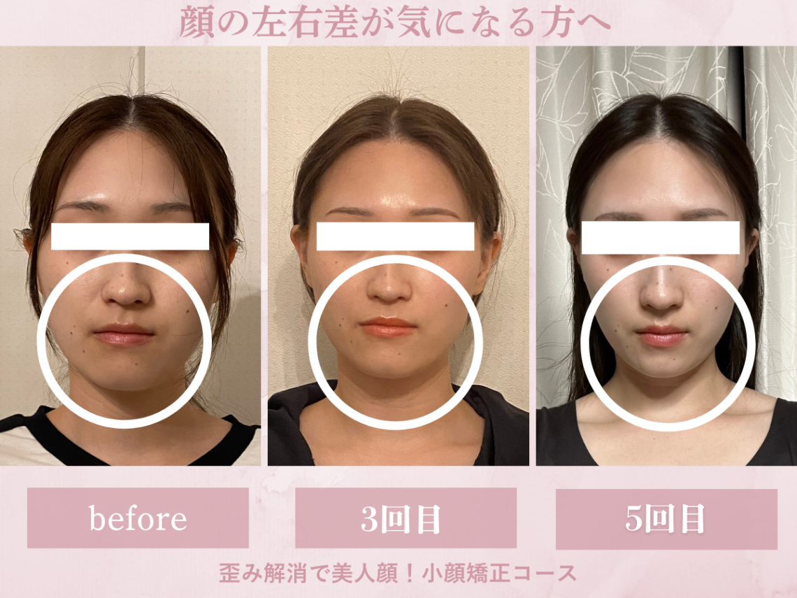 立体小顔矯正専門サロン　フラン