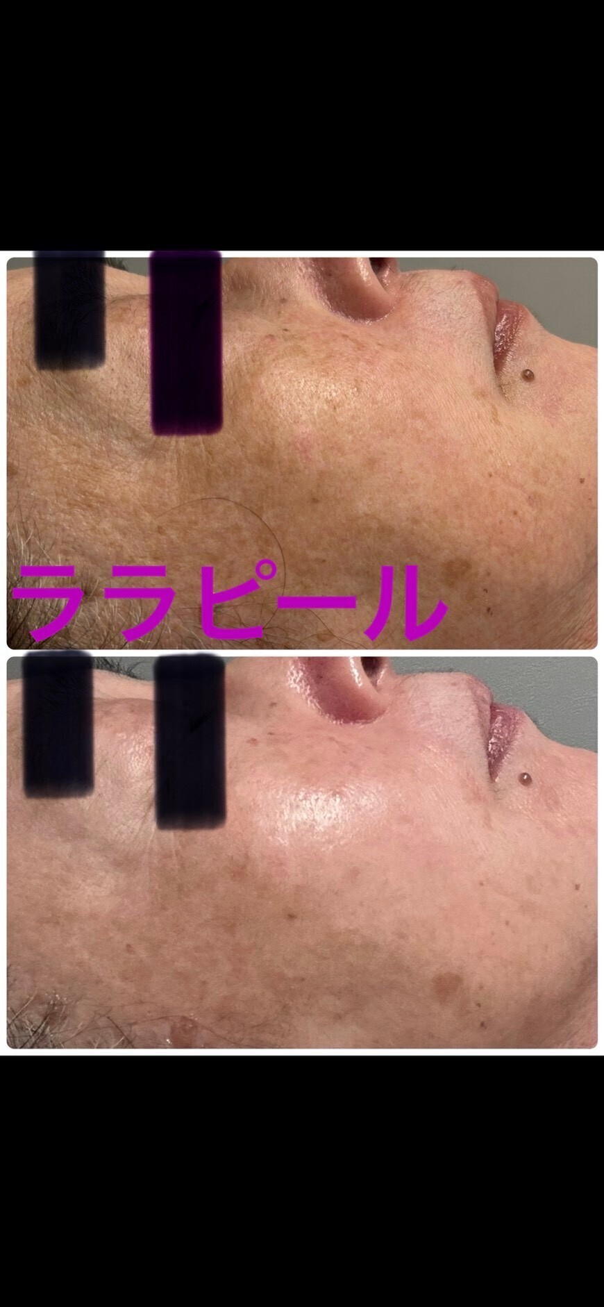 フェイシャルケア　チェスタ　メンズ可