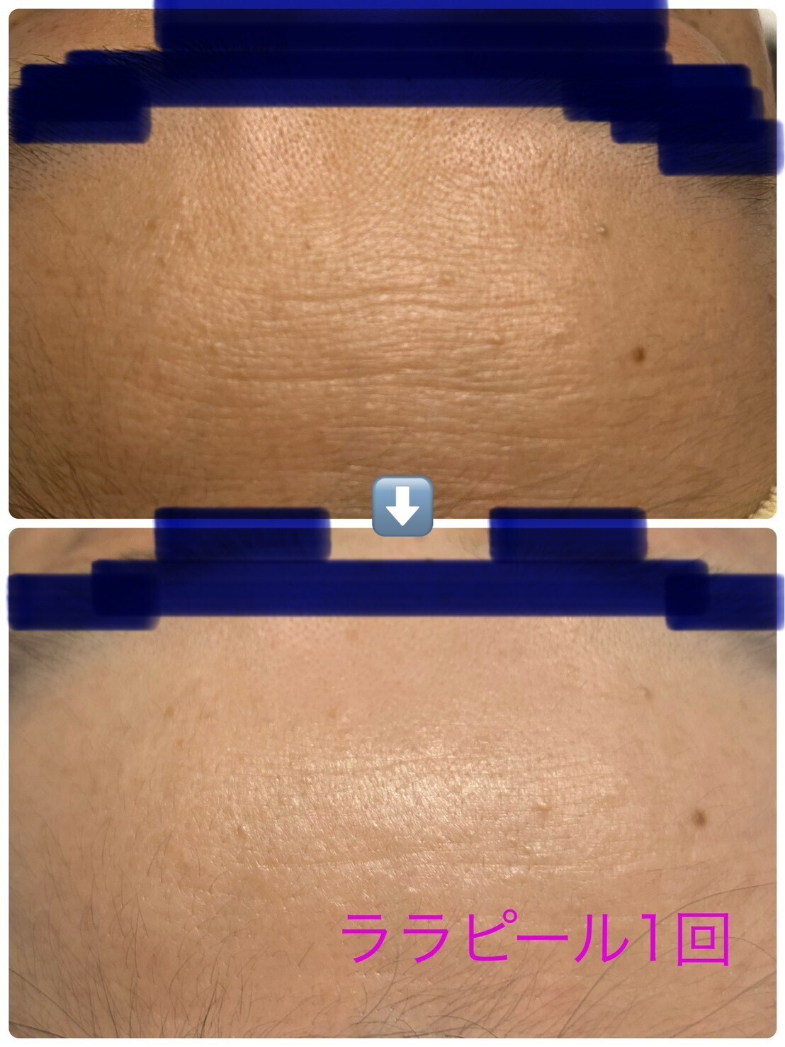 フェイシャルケア　チェスタ　メンズ可