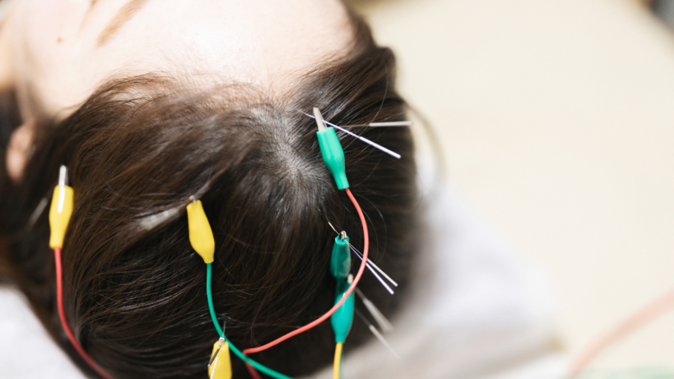 はりきゅうパンダ（大阪・谷町6丁目）