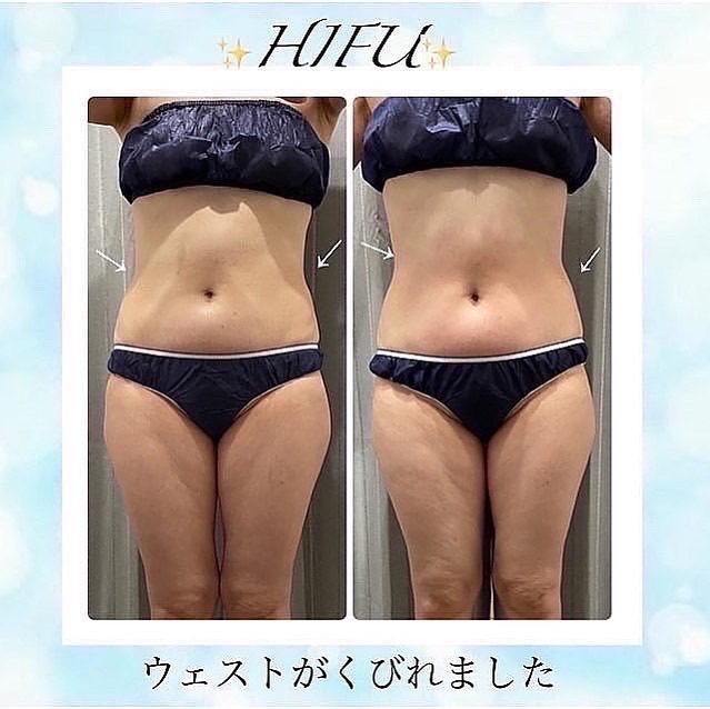 美肌とたるみ専門🌸ノーファンデになれる