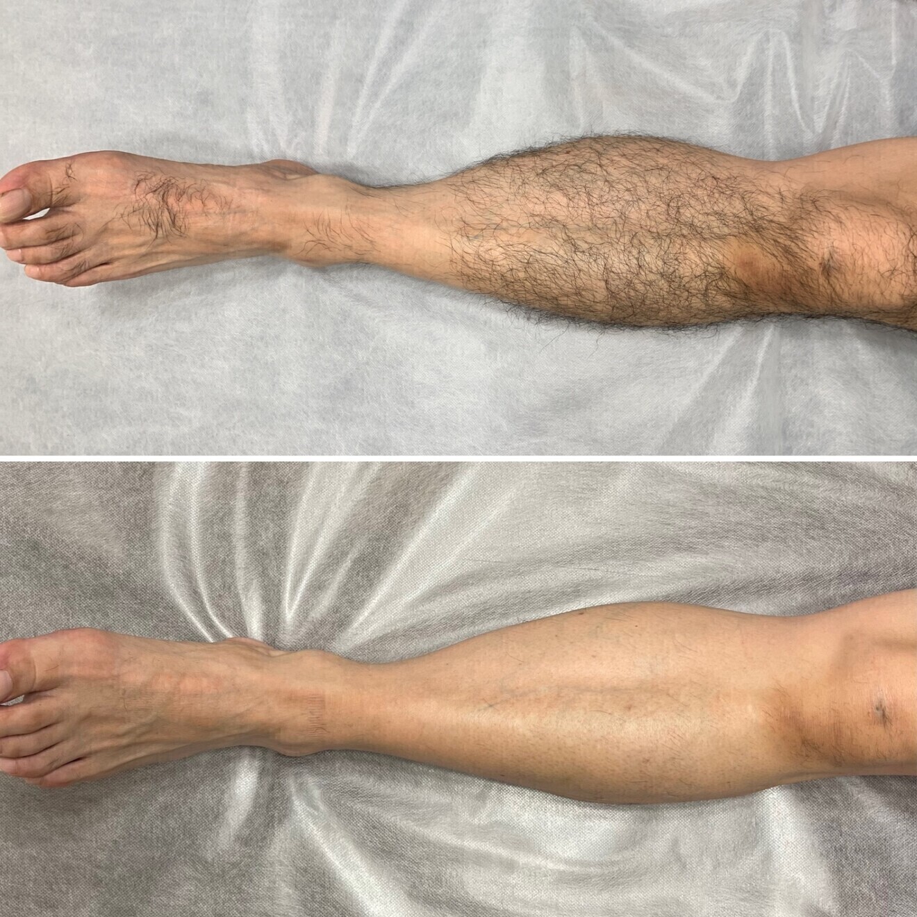 脱毛・肌質改善サロン R-LABO大阪