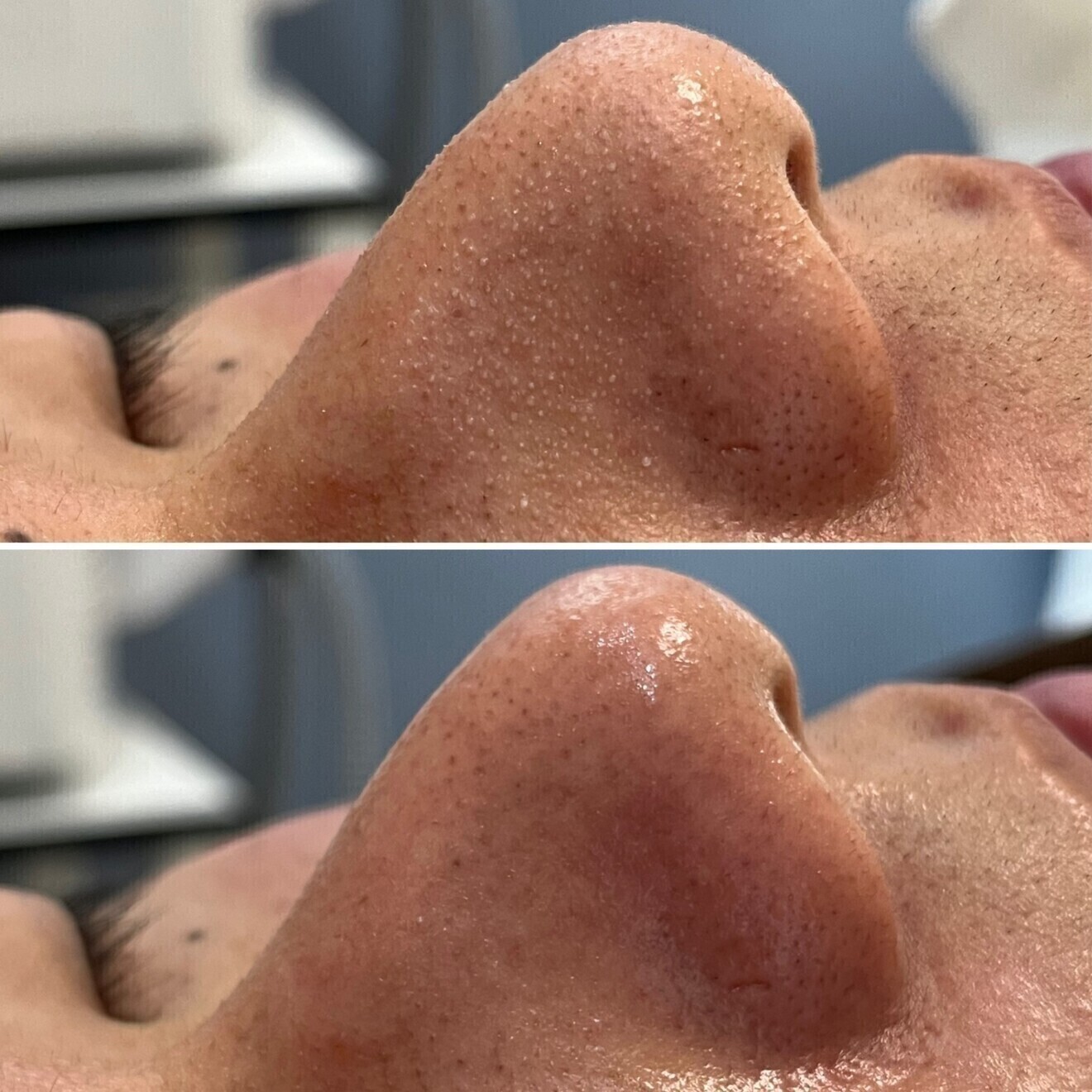 脱毛・肌質改善サロン R-LABO大阪