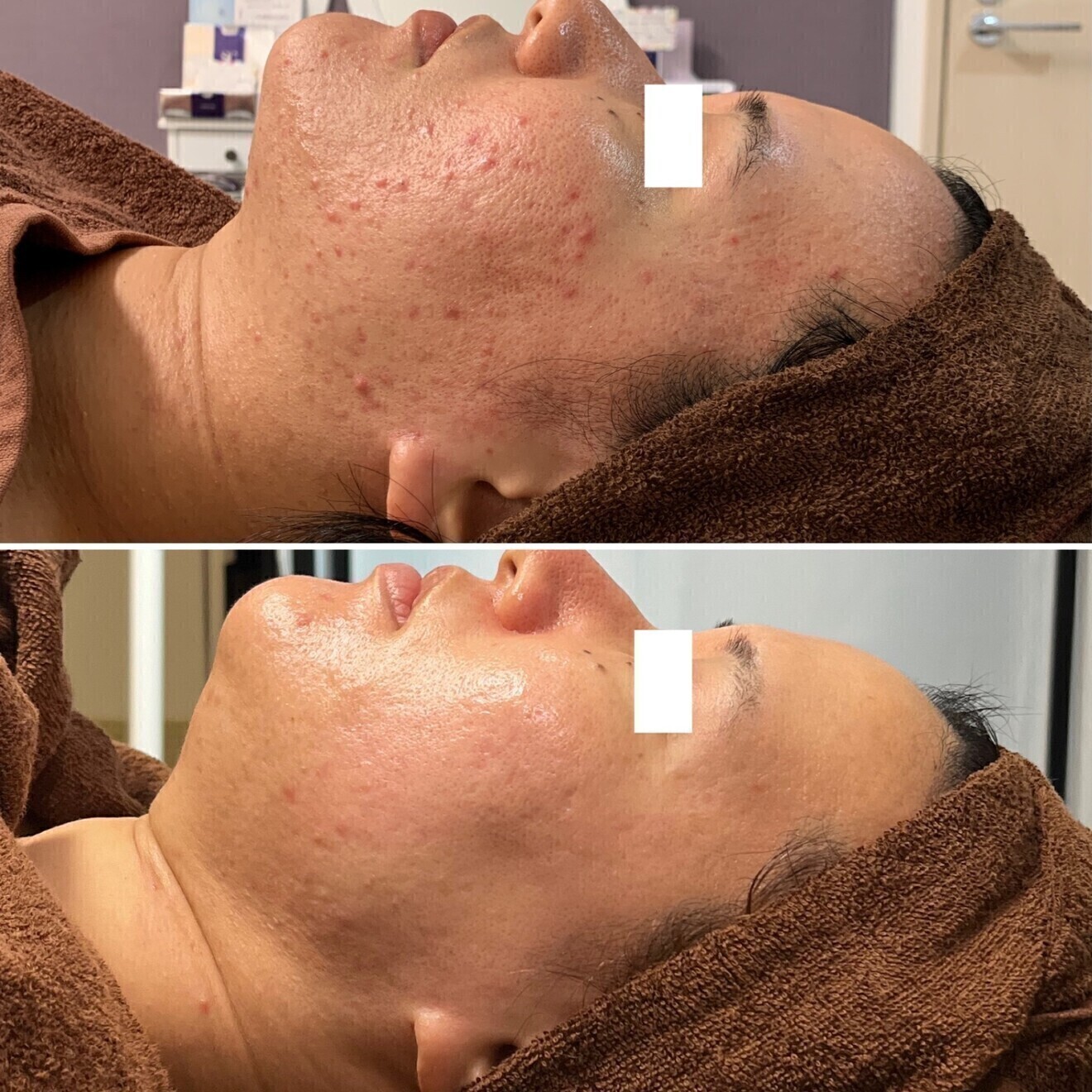 脱毛・肌質改善サロン R-LABO大阪