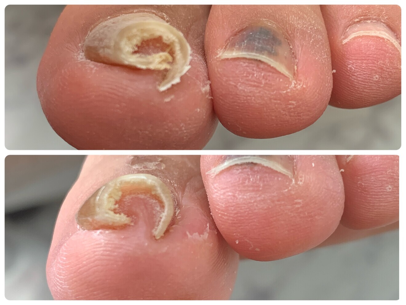 青森県八戸市☆爪の専門家ネイルクリスタル