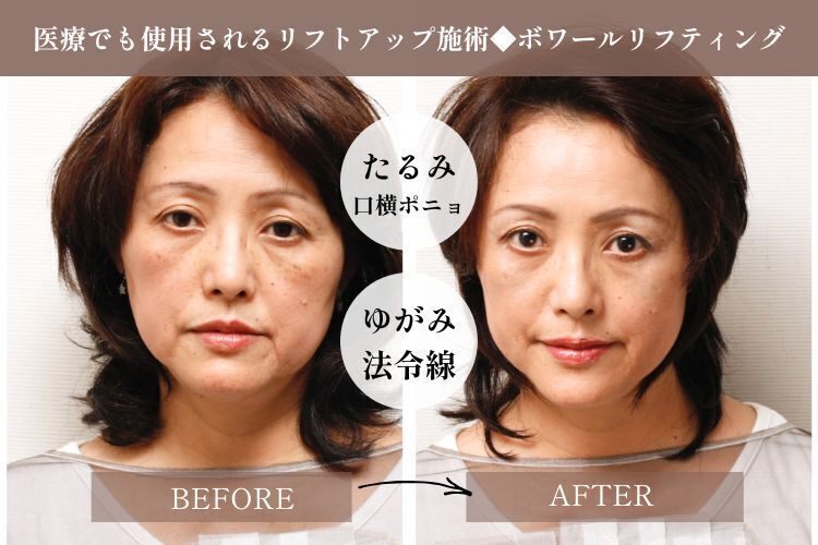 エステサロンアンジュマリー